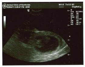 Ultrasound from March 4, 2011